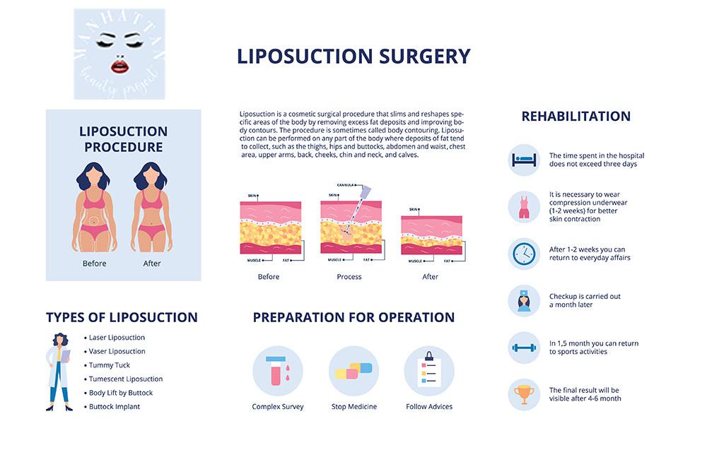 Manhattan Beauty Project: Liposuction